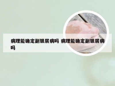 病理能确定副银屑病吗 病理能确定副银屑病吗