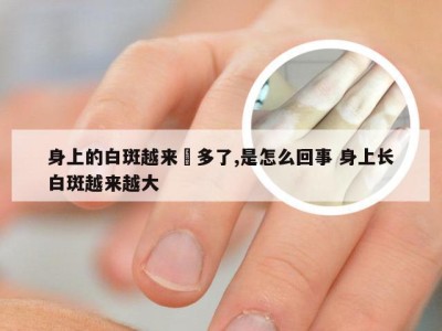 身上的白斑越来赿多了,是怎么回事 身上长白斑越来越大