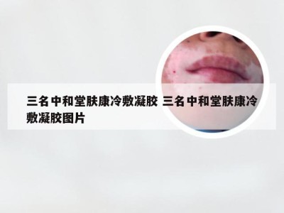 三名中和堂肤康冷敷凝胶 三名中和堂肤康冷敷凝胶图片