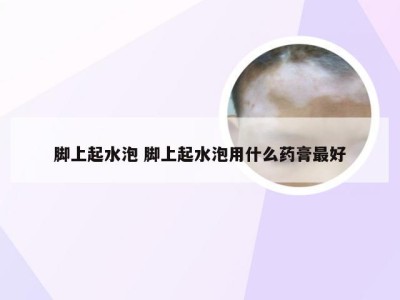 脚上起水泡 脚上起水泡用什么药膏最好