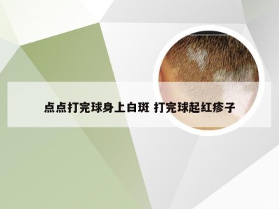 点点打完球身上白斑 打完球起红疹子