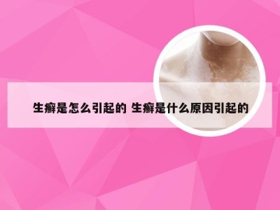 生癣是怎么引起的 生癣是什么原因引起的