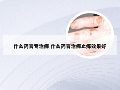 什么药膏专治癣 什么药膏治癣止痒效果好