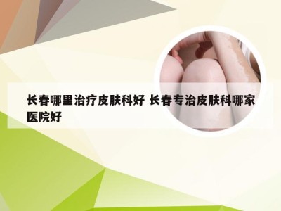 长春哪里治疗皮肤科好 长春专治皮肤科哪家医院好