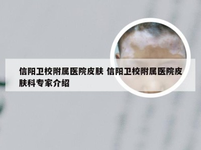 信阳卫校附属医院皮肤 信阳卫校附属医院皮肤科专家介绍