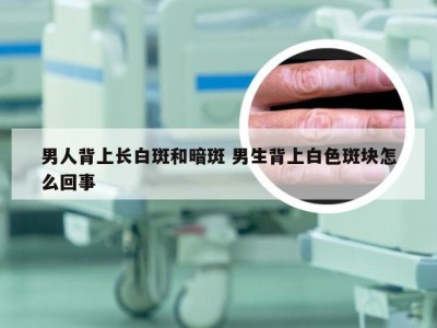 男人背上长白斑和暗斑 男生背上白色斑块怎么回事