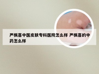 严枫喜中医皮肤专科医院怎么样 严枫喜的中药怎么样