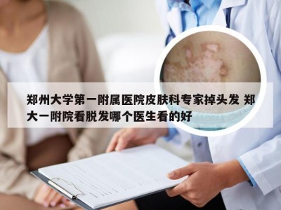 郑州大学第一附属医院皮肤科专家掉头发 郑大一附院看脱发哪个医生看的好