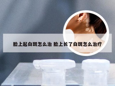 脸上起白斑怎么治 脸上长了白斑怎么治疗