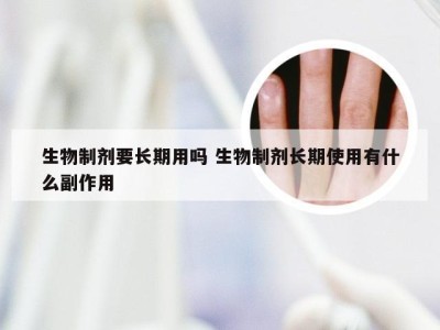 生物制剂要长期用吗 生物制剂长期使用有什么副作用