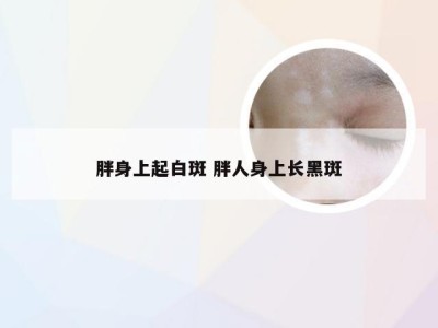 胖身上起白斑 胖人身上长黑斑