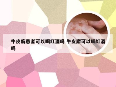 牛皮癣患者可以喝红酒吗 牛皮廨可以喝红酒吗