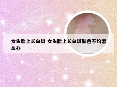 女生脸上长白斑 女生脸上长白斑肤色不均怎么办