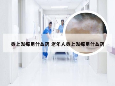 身上发痒用什么药 老年人身上发痒用什么药