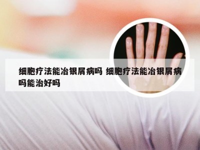 细胞疗法能冶银屑病吗 细胞疗法能冶银屑病吗能治好吗