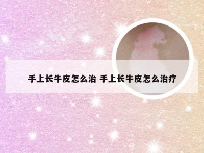 手上长牛皮怎么治 手上长牛皮怎么治疗