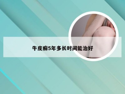 牛皮癣5年多长时间能治好