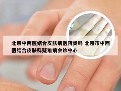 北京中西医结合皮肤病医院贵吗 北京市中西医结合皮肤科疑难病会诊中心