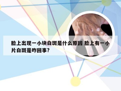 脸上出现一小块白斑是什么原因 脸上有一小片白斑是咋回事?