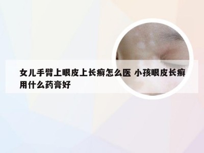 女儿手臂上眼皮上长癣怎么医 小孩眼皮长癣用什么药膏好