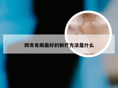 四支有癣最好的制疗方法是什么