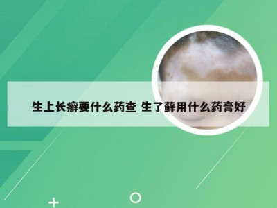 生上长癣要什么药查 生了藓用什么药膏好