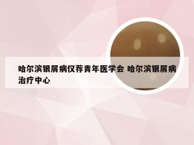 哈尔滨银屑病仅荐青年医学会 哈尔滨银屑病治疗中心