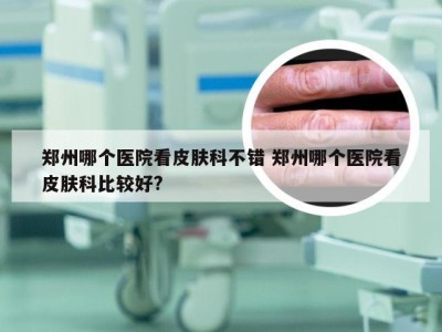 郑州哪个医院看皮肤科不错 郑州哪个医院看皮肤科比较好?