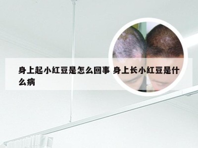 身上起小红豆是怎么回事 身上长小红豆是什么病