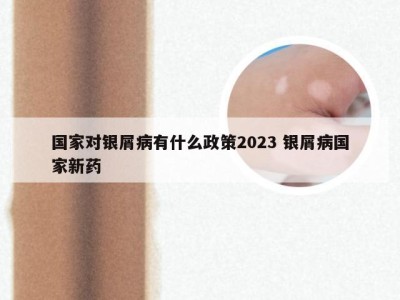 国家对银屑病有什么政策2023 银屑病国家新药