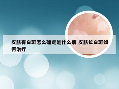 皮肤有白斑怎么确定是什么病 皮肤长白斑如何治疗