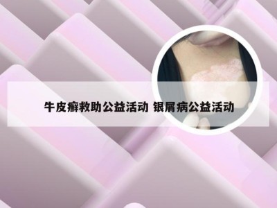 牛皮癣救助公益活动 银屑病公益活动