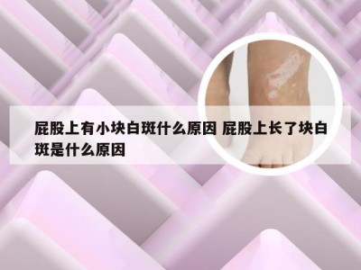 屁股上有小块白斑什么原因 屁股上长了块白斑是什么原因