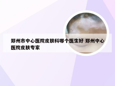 郑州市中心医院皮肤科哪个医生好 郑州中心医院皮肤专家