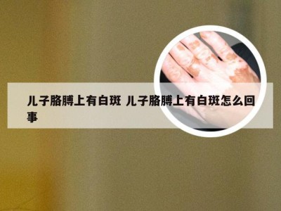 儿子胳膊上有白斑 儿子胳膊上有白斑怎么回事