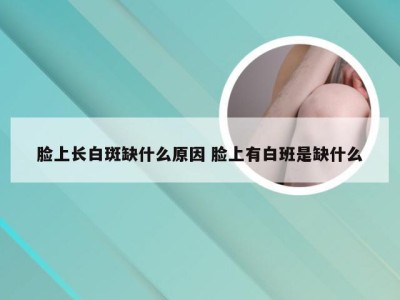 脸上长白斑缺什么原因 脸上有白班是缺什么