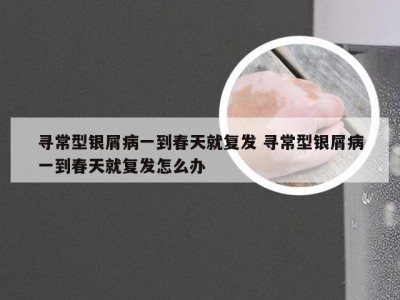 寻常型银屑病一到春天就复发 寻常型银屑病一到春天就复发怎么办