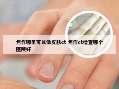 焦作哪里可以做皮肤ct 焦作ct检查哪个医院好