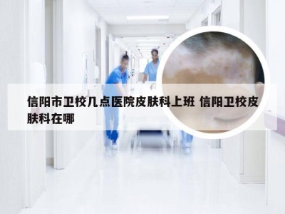 信阳市卫校几点医院皮肤科上班 信阳卫校皮肤科在哪