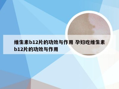 维生素b12片的功效与作用 孕妇吃维生素b12片的功效与作用