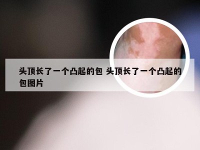 头顶长了一个凸起的包 头顶长了一个凸起的包图片