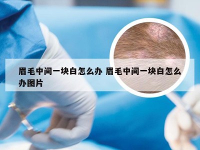 眉毛中间一块白怎么办 眉毛中间一块白怎么办图片