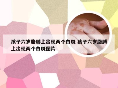 孩子六岁胳膊上出现两个白斑 孩子六岁胳膊上出现两个白斑图片