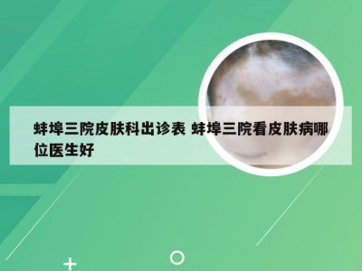 蚌埠三院皮肤科出诊表 蚌埠三院看皮肤病哪位医生好