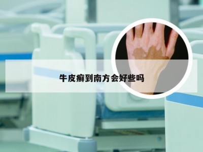 牛皮癣到南方会好些吗