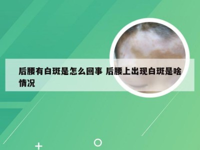 后腰有白斑是怎么回事 后腰上出现白斑是啥情况