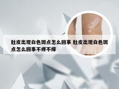 肚皮出现白色斑点怎么回事 肚皮出现白色斑点怎么回事不疼不痒