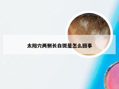 太阳穴两侧长白斑是怎么回事