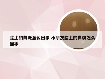 脸上的白斑怎么回事 小朋友脸上的白斑怎么回事