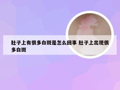 肚子上有很多白斑是怎么回事 肚子上出现很多白斑